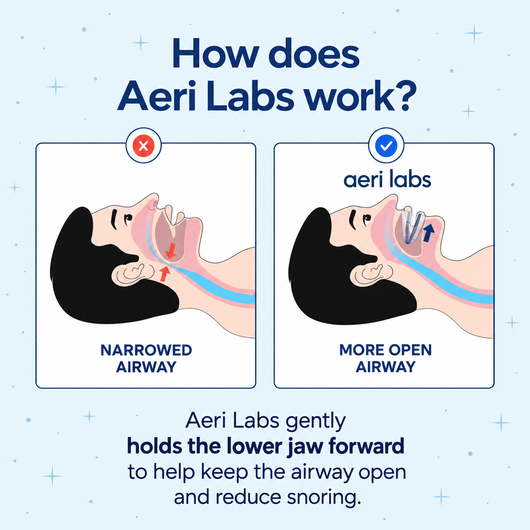 aeri labs® Anti-Snoring Mouthpiece
